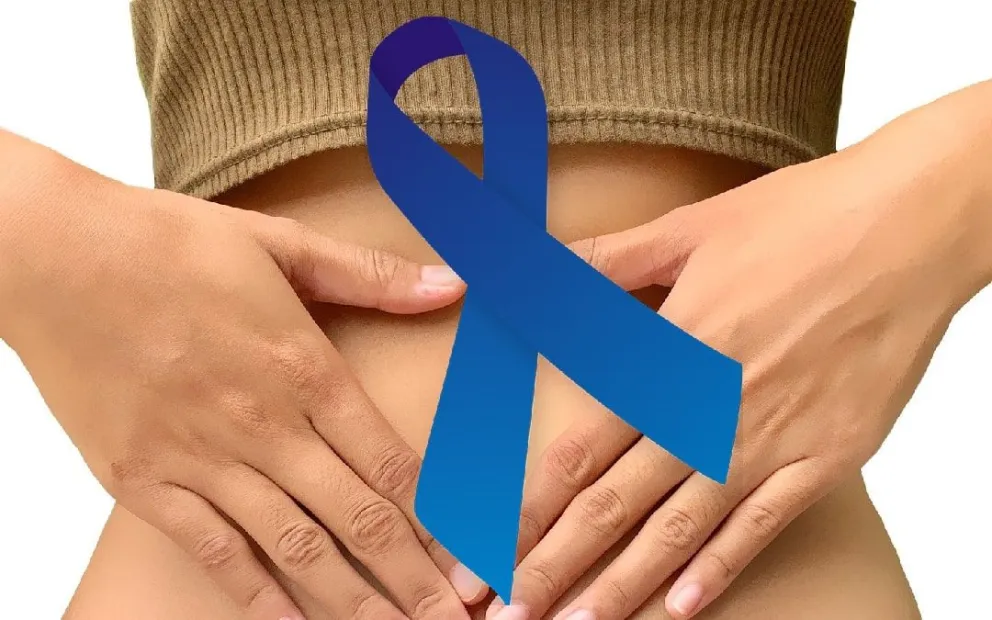 Día Mundial contra el Cáncer de Colon: 9 de cada 10 casos son prevenibles